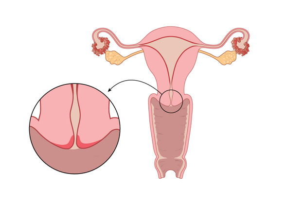Cervical Mucus Meaning #fertility #mucus #cervicalmucus #womananatomy , mucus
